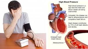 Penyebab Hipertensi